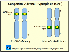 Congenital Adrenal Hyperplasia CAH