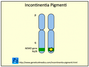 Incontinentia pigmenti