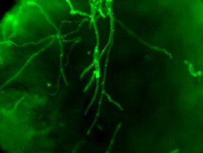 Fluorescent microscopy of dermatophyte hyphae