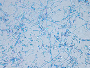 Dermatophyte microscopy
