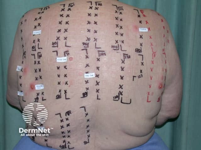 Reading the patch tests - there are several positives