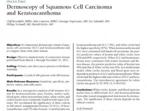 Abstract: Rosendahl C et al Dermatoscopy of squamous cell carcinoma and keratoacanthoma. Arch Dermatol 2012; 148: 1386-92