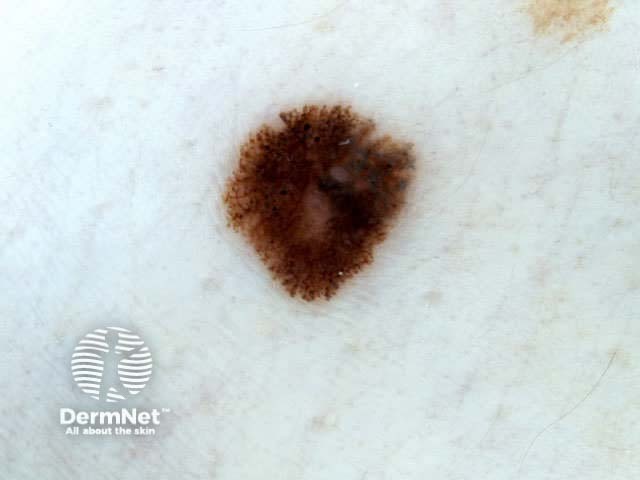 Sharp cut-off all round