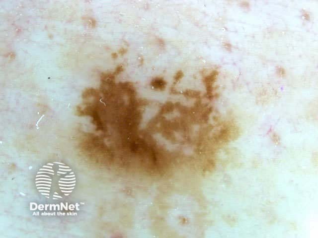 Homogeneous structure