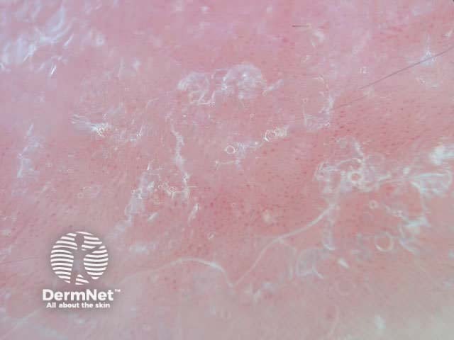 Uniform small globluar vessels