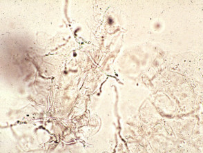 Microscopy of Microsporum canis