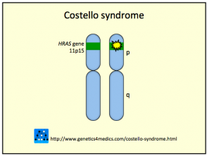 Costello Syndrome