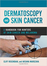 Dermatoscopy skin cancer