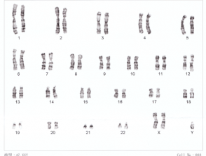 Human chromosomes XXY