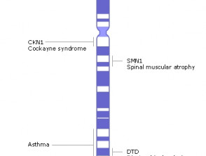 Human chromosome 05 displaying location of Cockayne syndrome A gene