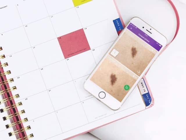 Skin mole photo app