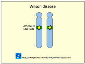 Wilson Disease