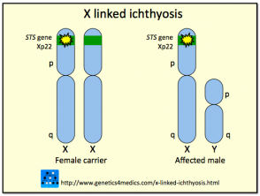 X linked Ichthyosis