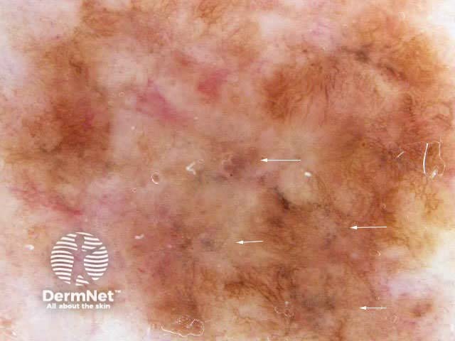 Blue pepper granules