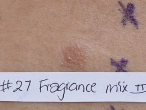 Positive patch test to fragrance mix II
