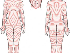 Skin tension lines